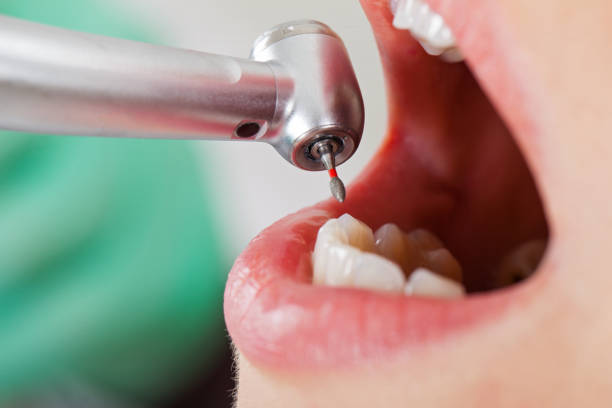 Best Urgent Care for Lost Fillings or Crowns in Green Cove Springs, FL